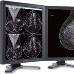 Monitores de Grado Médico