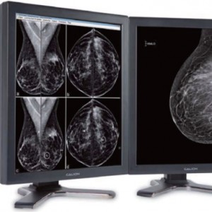 Monitores de Grado Médico